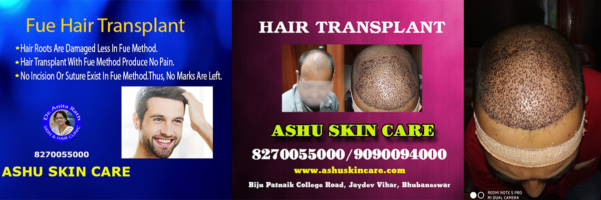 Dr Anita Rath |Best Lady hair transplant & Aesthetic Surgeon in Bhubaneswar ,Odisha